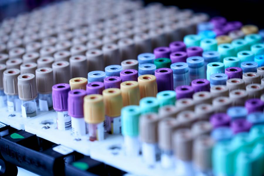 Análisis de colesterol en Farmacia Batoy, en Alcoy<br />
